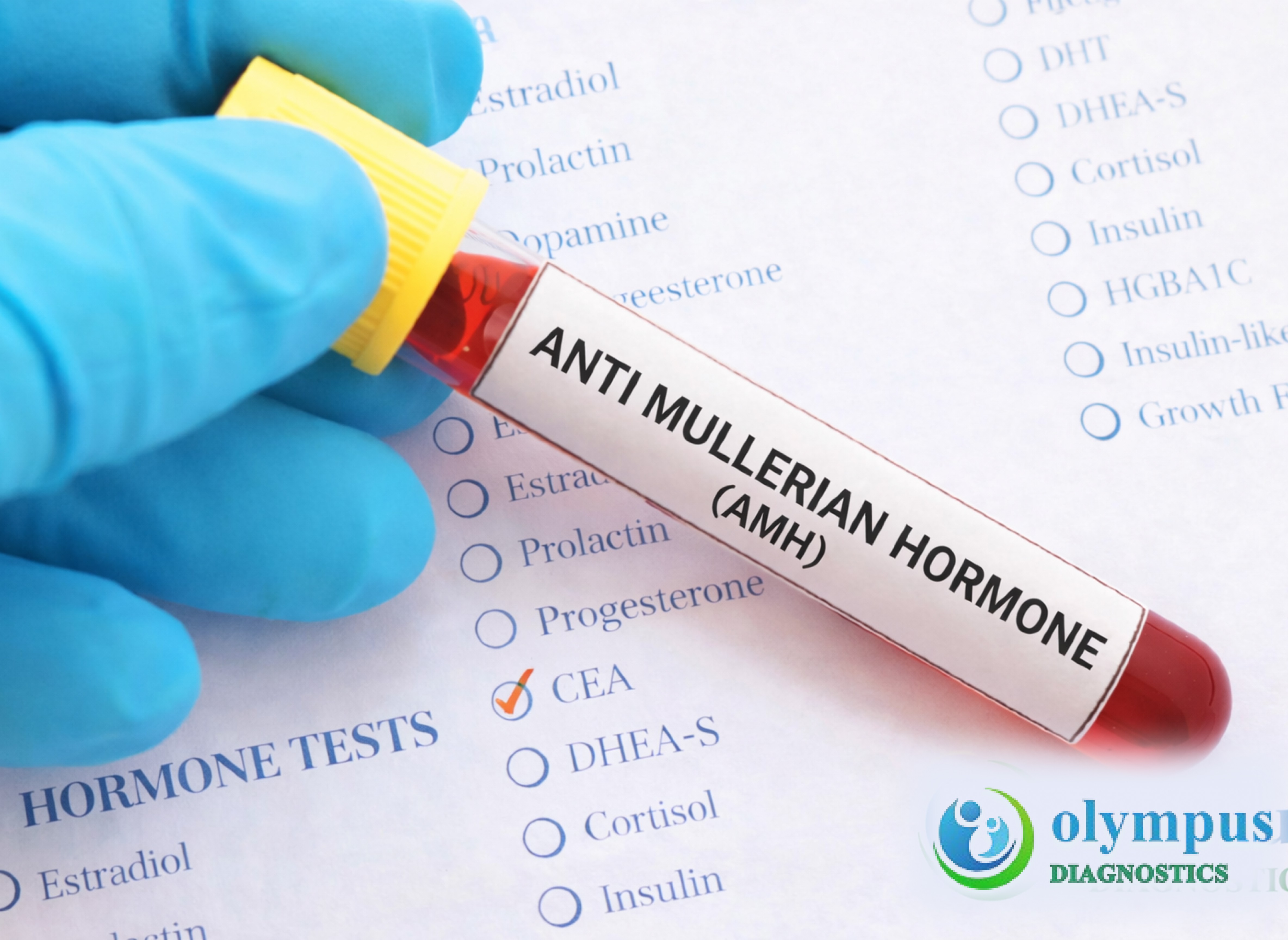ANTI MULLERIAN HORMONE(AMH)