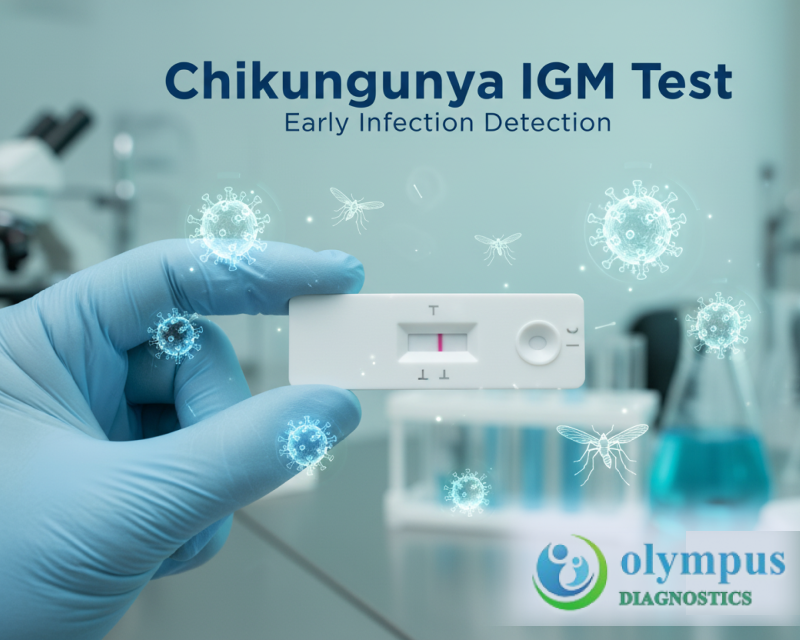CHIKUNGUNYA IgM