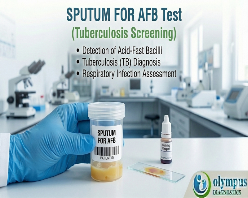 SPUTUM FOR AFB