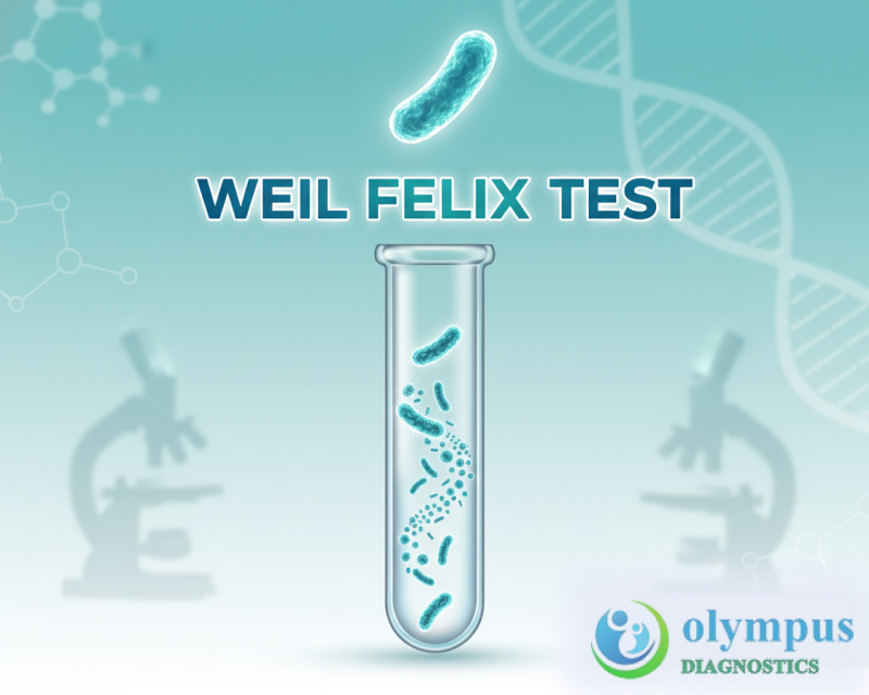 WEIL FELIX TEST