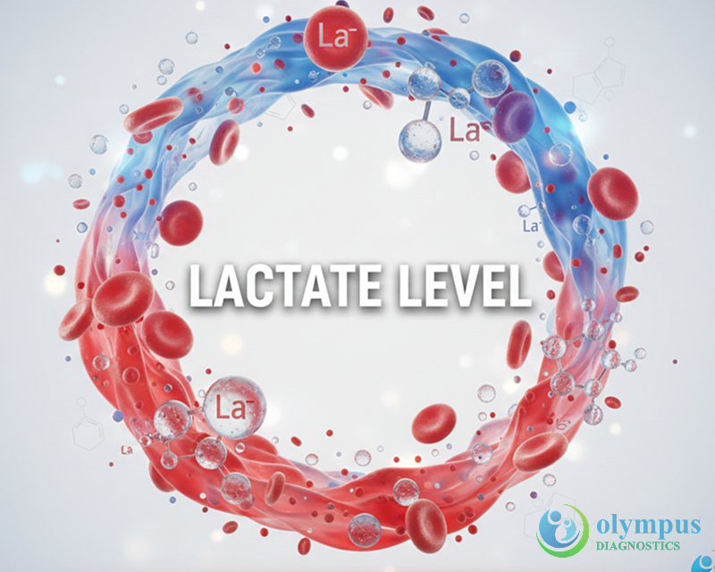 LACTATE LEVEL